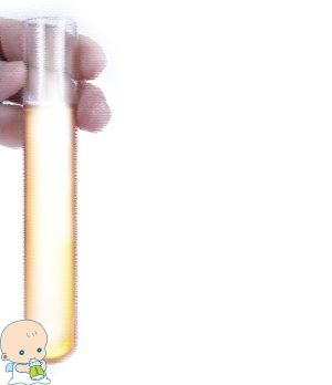 顕微授精 ICSI